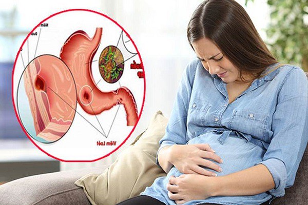 Bà bầu đau dạ dày khi mang thai 3 tháng đầu, 3 tháng cuối phải làm sao?