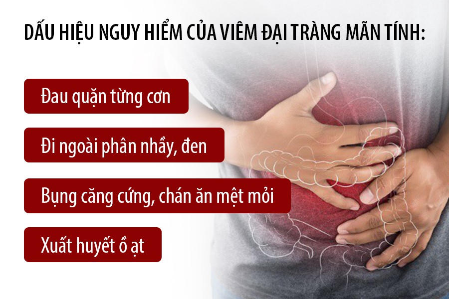 Viêm đại tràng mãn tính: Khái niệm và kiến thức về bệnh mãn tính Viêm đại tràng mãn tính: Khái niệm và kiến thức về bệnh mãn tính