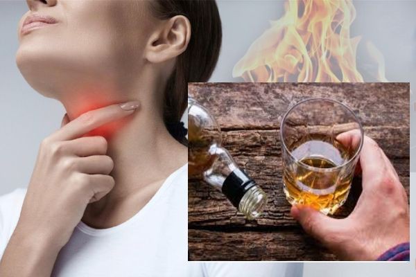 Đau họng sau khi uống rượu: Cách dập tắt hệ lụy của “ma men”