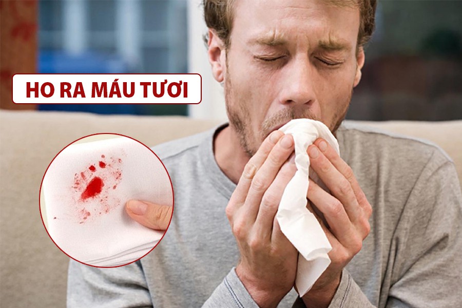 Ho ra máu là bệnh gì? Triệu chứng, nguyên nhân và cách chữa trị