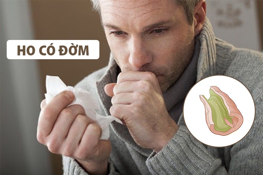 Ho có đờm kéo dài là gì? Nguyên nhân, triệu chứng, thuốc trị cho trẻ