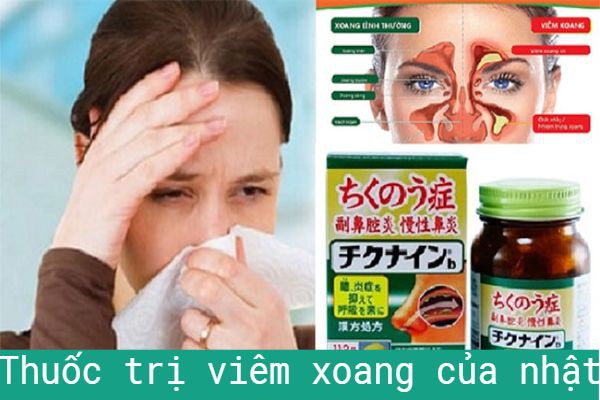 8 Thuốc trị viêm xoang của nhật dạng xịt mang đẳng cấp Japan